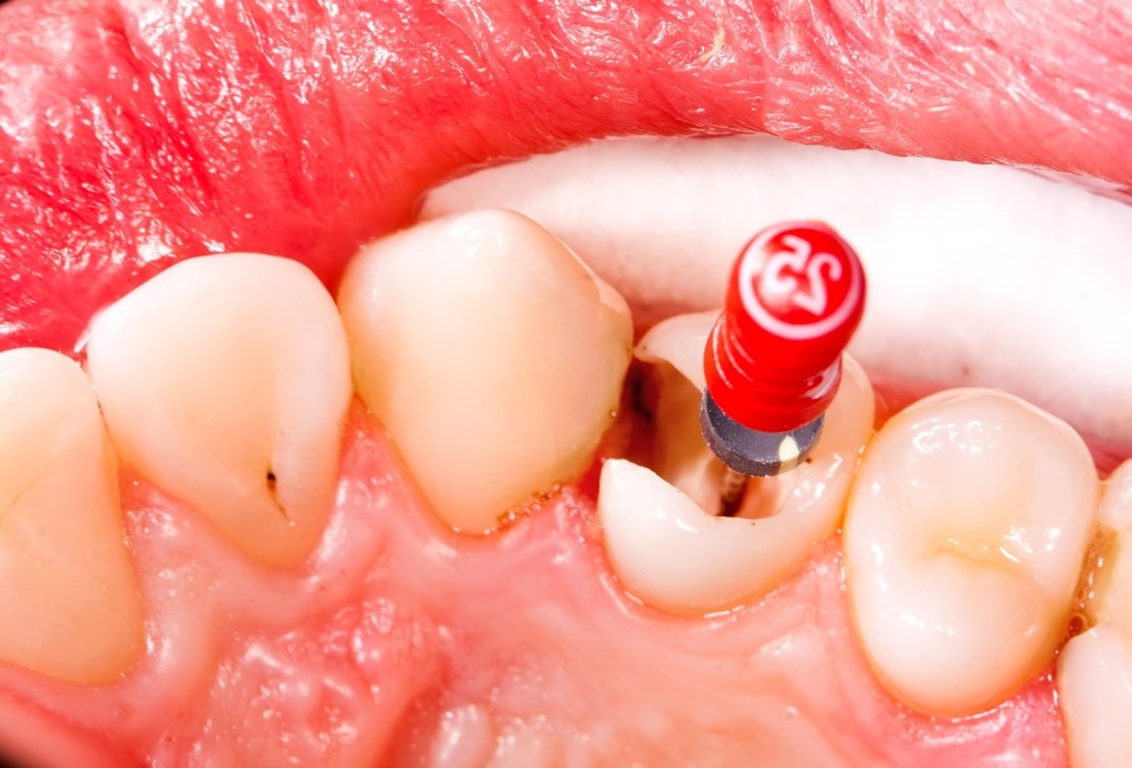 podstawowe-leczenie-stomatologiczne-exceldent-nowoczesna